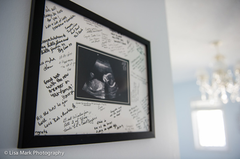 Ultrasound Picture Frame